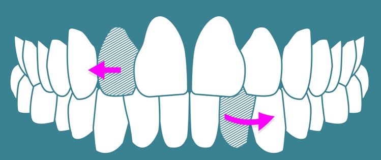 استارت‌آپ‌هایی که دندان‌های شما را نشانه گرفته‌اند!