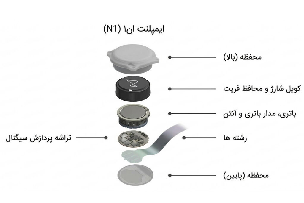 اگر نورالینک هک شود چه اتفاقی می‌افتد؟ ۵ سناریو برای حمله به تراشه مغزی ایلان ماسک